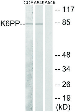Anti-K6PP antibody produced in rabbit