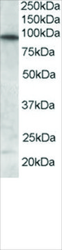 Anti-FOXO3A/FKHRL1 antibody produced in goat
