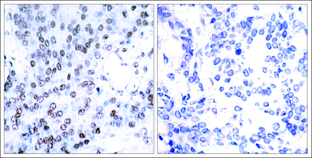 Anti-JUNB (Ab-79) antibody produced in