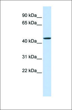 Anti-JMJD4 antibody produced in rabbit
