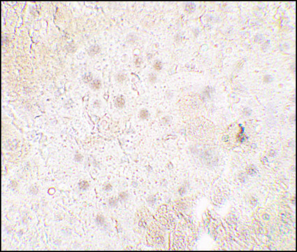 Anti-TMIGD1 antibody produced in rabbit