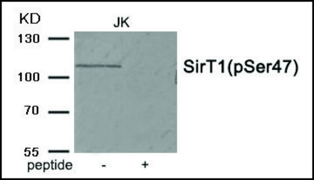 Anti-phospho-SirT1 (pSer??) antibody produced in