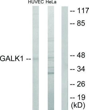 Anti-GALK1 antibody produced in rabbit