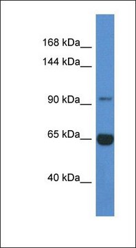 Anti-MAN2A2 antibody produced in rabbit