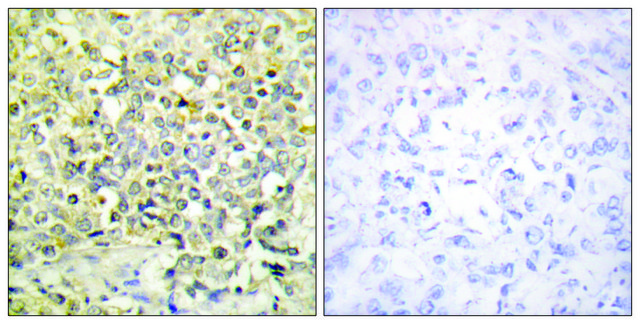 Anti-CDKL4 antibody produced in rabbit