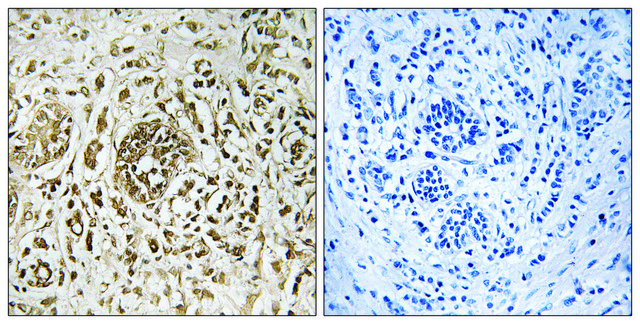 Anti-CIB2 antibody produced in rabbit