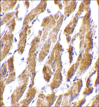 Anti-CRTH2 antibody produced in rabbit