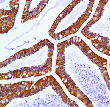 Anti-C-ERBB3 antibody, Rabbit monoclonal