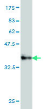 Monoclonal Anti-PPP3CB antibody produced in