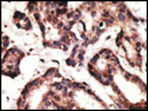 Anti-LRP1 (C-term) antibody produced in
