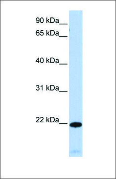 Anti-RGS5 antibody produced in rabbit