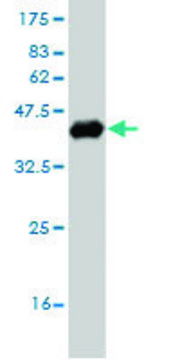 ANTI-OTX1 antibody produced in mouse