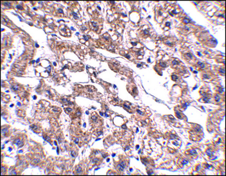 Anti-MACC1 antibody produced in rabbit