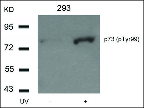 Anti-phospho-TP73 (pTyr??) antibody produced in