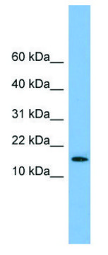 Anti-SPA17 (N-terminal) antibody produced in