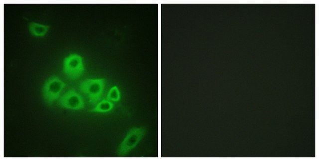 Anti-S1P Receptor EDG1 antibody produced