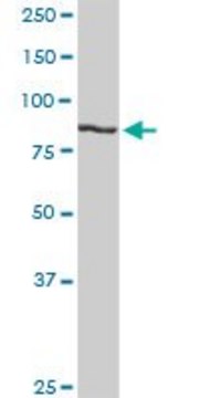 Anti-H6PD antibody produced in rabbit