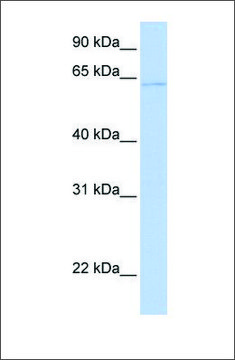 Anti-PPAT antibody produced in rabbit