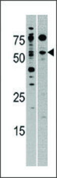 Anti-NCBP2 (C-term) antibody produced in