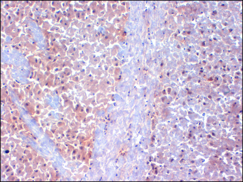 Monoclonal Anti-KCNAB1 antibody produced in