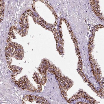 Anti-LRRC24 antibody produced in rabbit