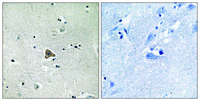 Anti-Claudin 4 antibody produced in