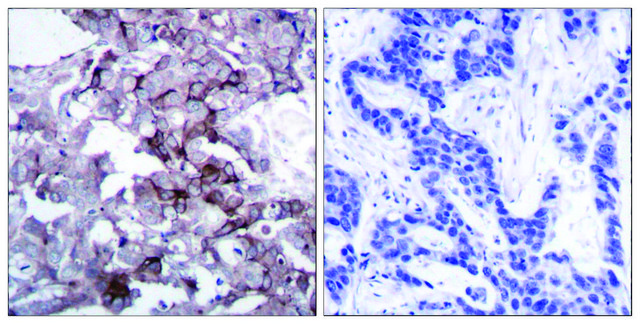 Anti-EGFR antibody produced in rabbit