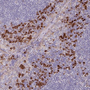 Anti-TRAPPC10 antibody produced in rabbit