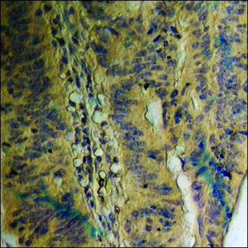 Anti-phospho-EGFR (pThr??³) antibody produced in