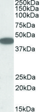 Anti-CXCR6 (C-terminal) antibody produced in