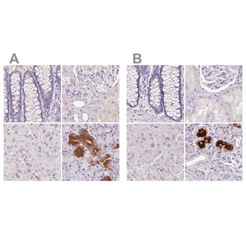 Anti-BPIFB2 antibody produced in rabbit