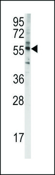 ANTI-CYP4F8(C-TERMINAL) antibody produced in rabbit