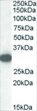 Anti-Monoglyceride lipase antibody produced in