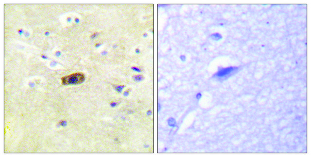 Anti-NMDAR2A antibody produced in rabbit