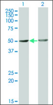 Monoclonal Anti-OMD antibody produced in