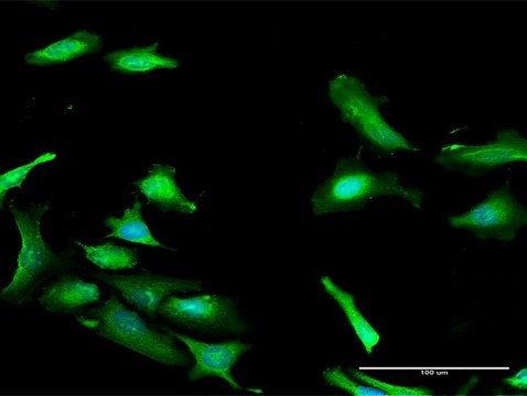 Anti-PDCD2 antibody produced in rabbit