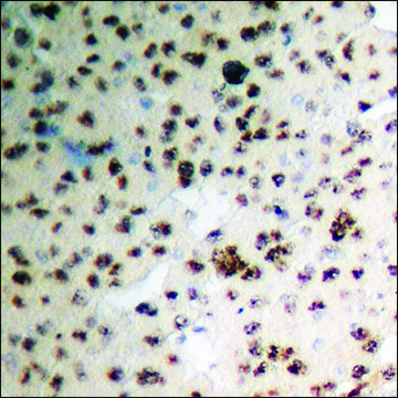 Anti-phospho-ACC1 (pSer??) antibody produced in