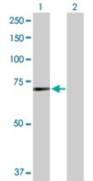 Anti-MEN1 antibody produced in rabbit