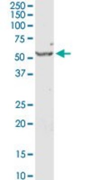 Anti-SERPINE1 antibody produced in rabbit