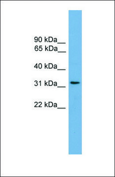 Anti-CCDC117 antibody produced in rabbit