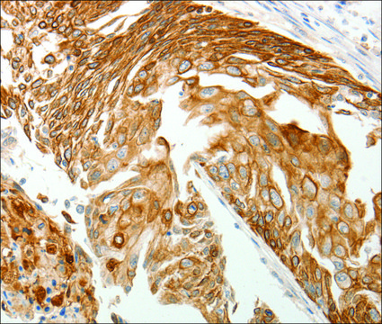 Anti-TMSB10 antibody produced in rabbit