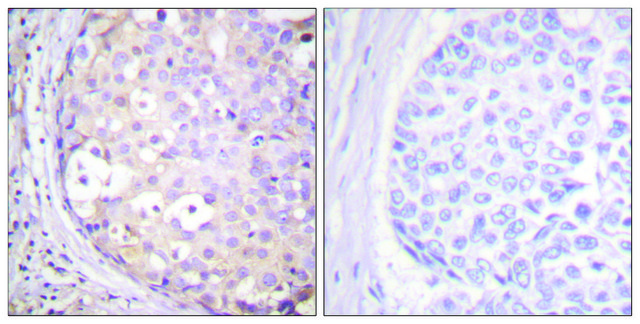 Anti-PKC-PAN antibody produced in rabbit