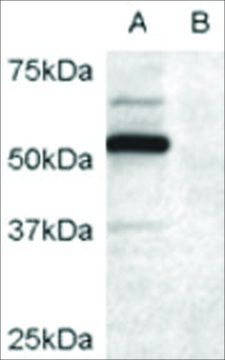 Anti-DCDC2 antibody produced in goat