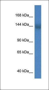 Anti-TMEM2 antibody produced in rabbit