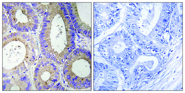 Anti-CBR3 antibody produced in rabbit