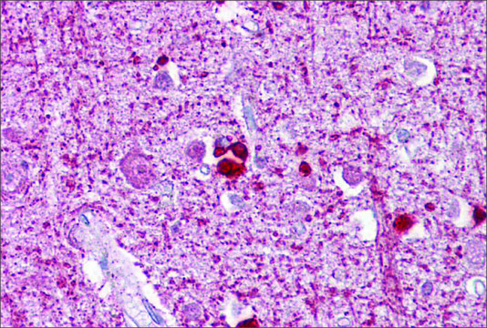 Anti-ZEB2 antibody produced in rabbit