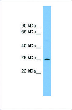 Anti-NOTO, (N-terminal) antibody produced in