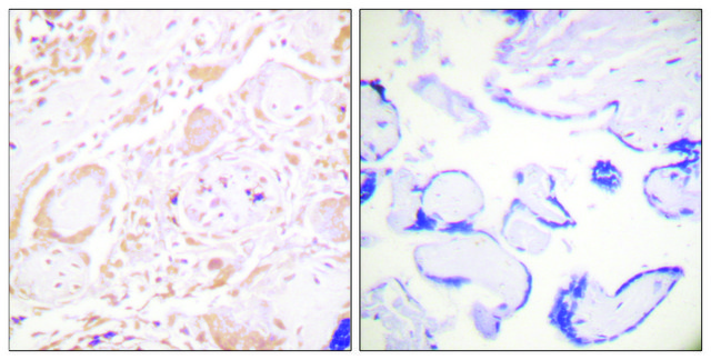 Anti-GATA3 antibody produced in rabbit