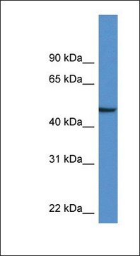 Anti-NPTX1 antibody produced in rabbit