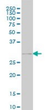 Monoclonal Anti-GSC, (C-terminal) antibody produced